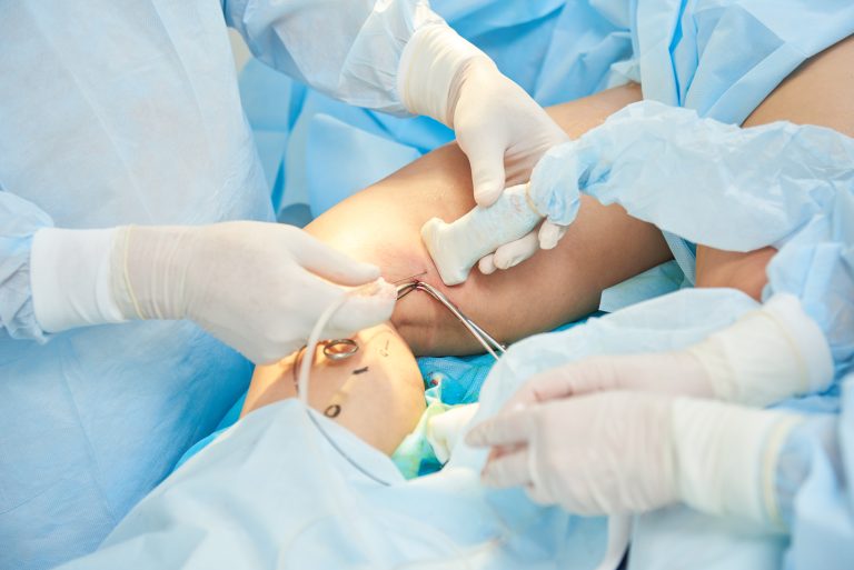 Photo d'une chirurgie vasculaire